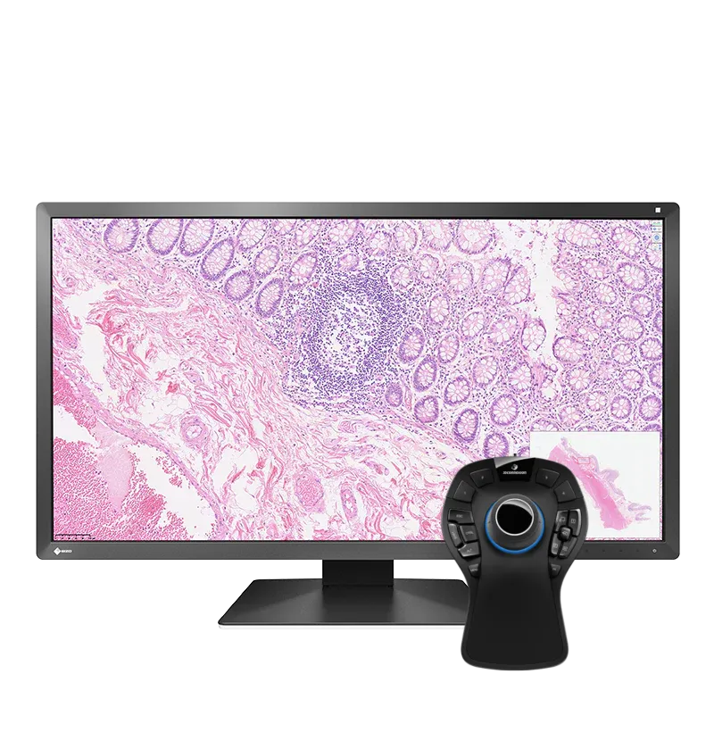 Pack EIZO PX3150 30,5" + SpaceMouse Pro Pathologie
