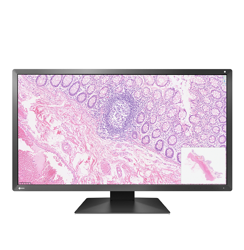 Pack EIZO PX3150 30,5" + SpaceMouse Pro Pathologie