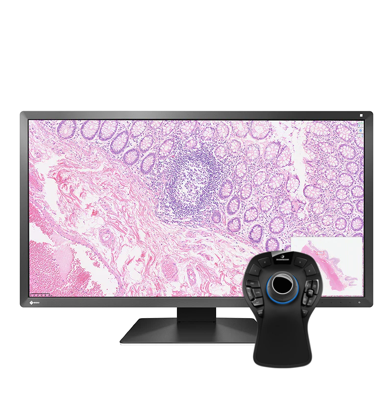 Pack EIZO PX3150 30,5" + SpaceMouse Pro Pathologie